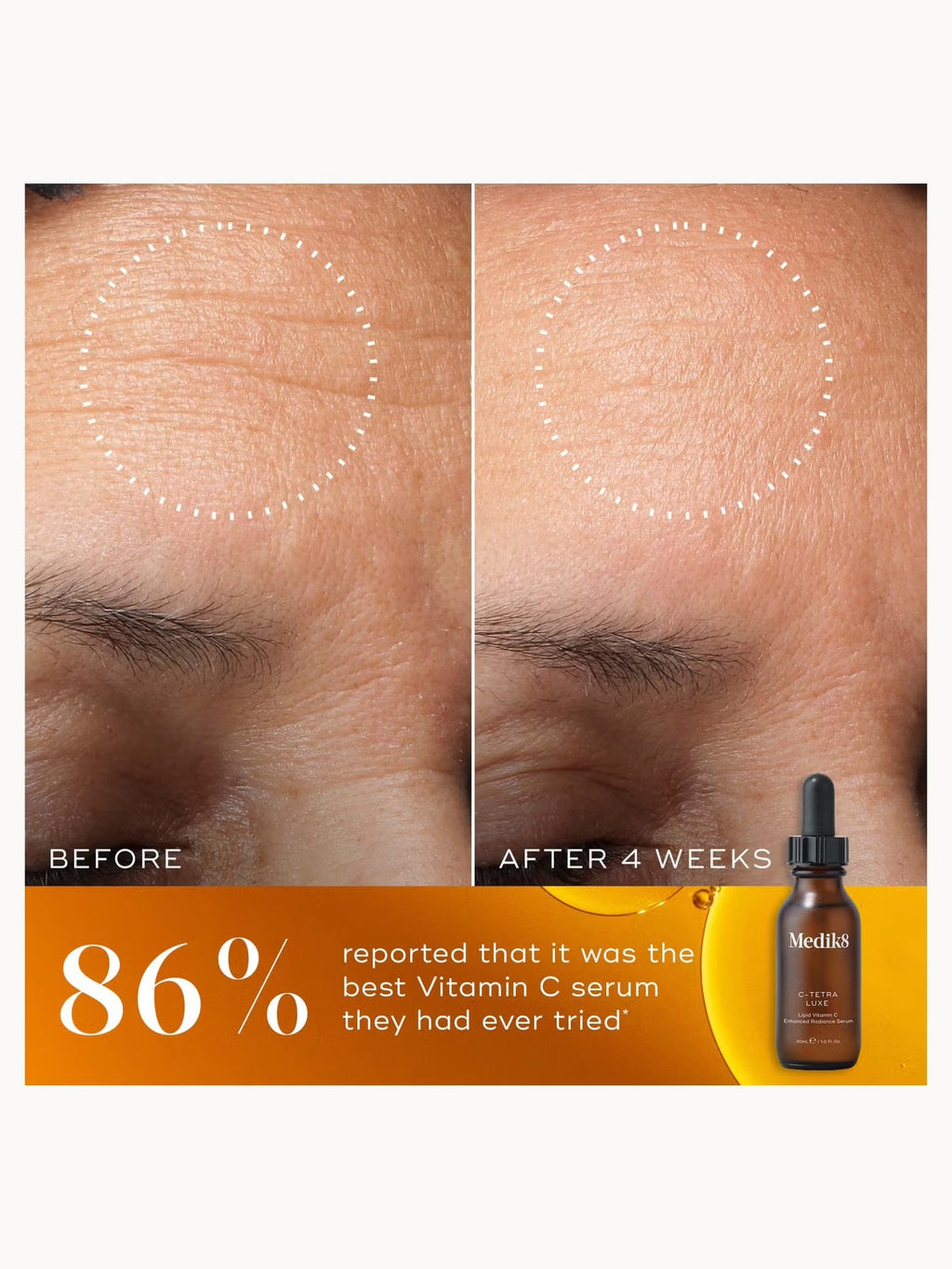 C-Tetra Luxe Vitamin C
