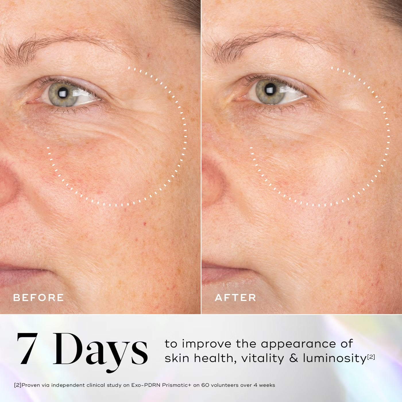 Exo-PDRN Prismatic+ Serum