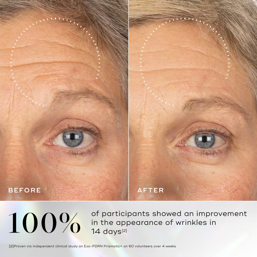 Exo-PDRN Prismatic+ Serum