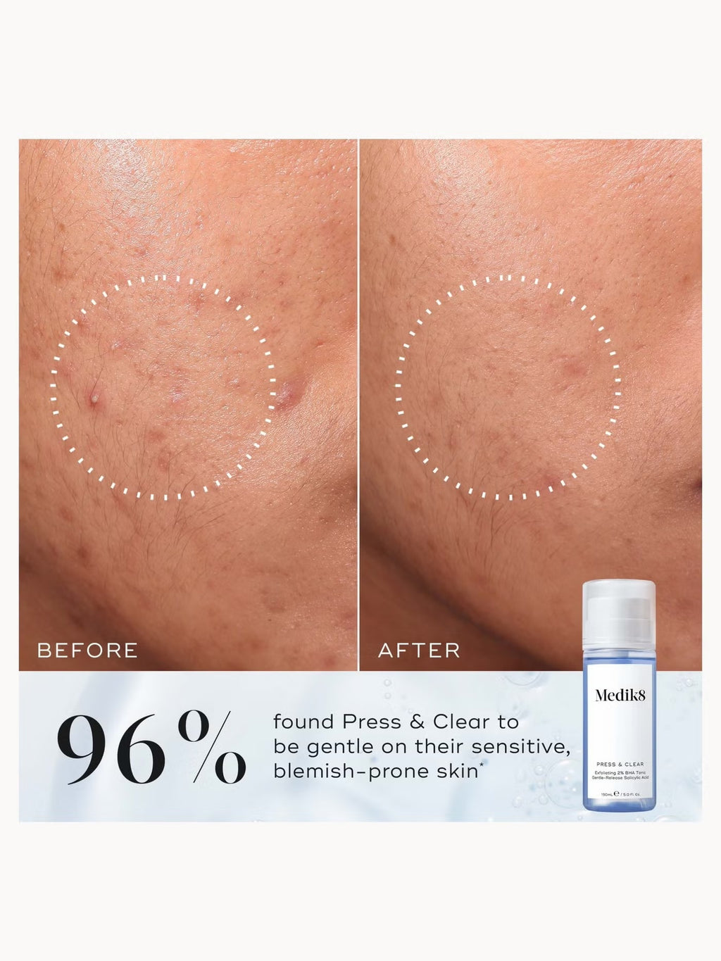 Press and Clear