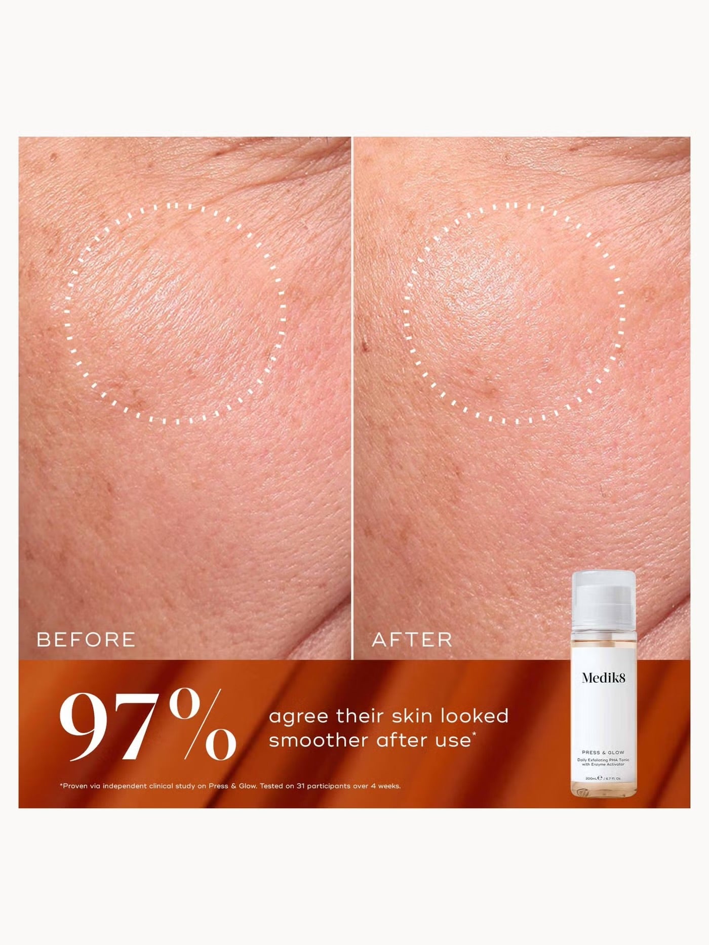 Luminous Lift (Worth £91)